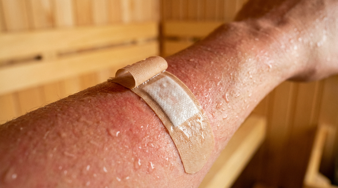 Sich ablösendes Pflaster auf verschwitzter Haut zeigt warum mit Pflaster in die Sauna problematisch ist